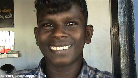 A 32-tooth smile