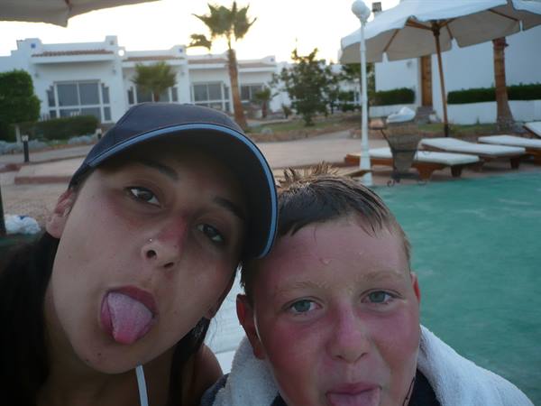 Girl in cap and sunburned boy sticking out tongues by poolside with umbrellas