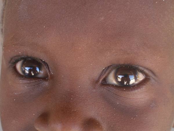 Close-up of a child's face, dark eyes reflecting the light
